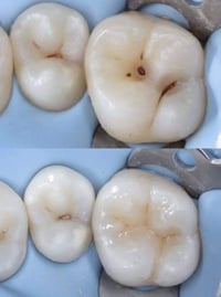 #خدمات_علاجيه_مجانيه_لطب_الفم_والاسنان ●  عيادة الاطفال  تقويم للاطفال...