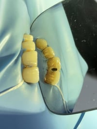 مستحيل خطأ واحد بالفرشاة يخلي أسنانك أضعف مع الوقت!”  حالة اليوم مراجع...