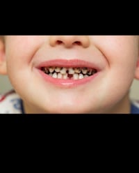 علاج اسنان مجاني • جامعة الكوفة • تقويم اسنان