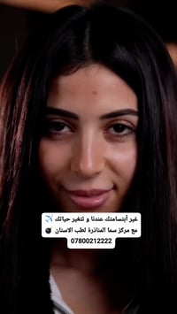 ابتسامة • تجميل أسنان • مركز سما المناذرة