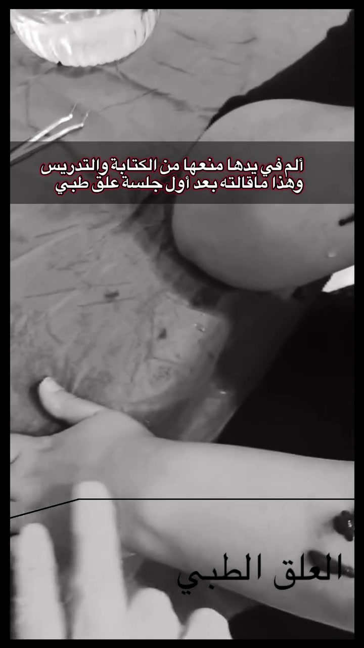 معلمة اتت اليوم تكول   قبل ما أجي، كنت ما أگدر أكتب على السبورة، ولا أگدر أسوي أبسط أعمال البيت من شدة ألم إيدي…

واليوم، الحمد لله، گدرت أغسل، وأشطف، وأفرم، وإيدي رجعت أحسن.”

هذه شهادة حقيقية من إحدى المراجعات بعد تجربتها مع العلق الطبي.

نسأل الله أن يتم عليها الصحة والعافية، وأن يشفي كل مريض. 🤍

⚠️ النتائج تختلف من شخص لآخر، ويُقيَّم كل مريض حسب حالته

للتواصل واتساب
***********
