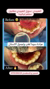 عيادة سوما • طب وتجميل الأسنان • العبيدي