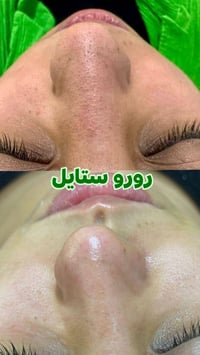 حله شارع 60 • عروس يوم واحد • هيدرفشل