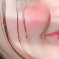 خلطة ايرانيه • صابونه • كلف نمش