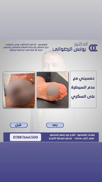 خمسيني مع عدم السيطره ع السكري ...  الدكتور يونـس الرضواني اختصاص جراح...