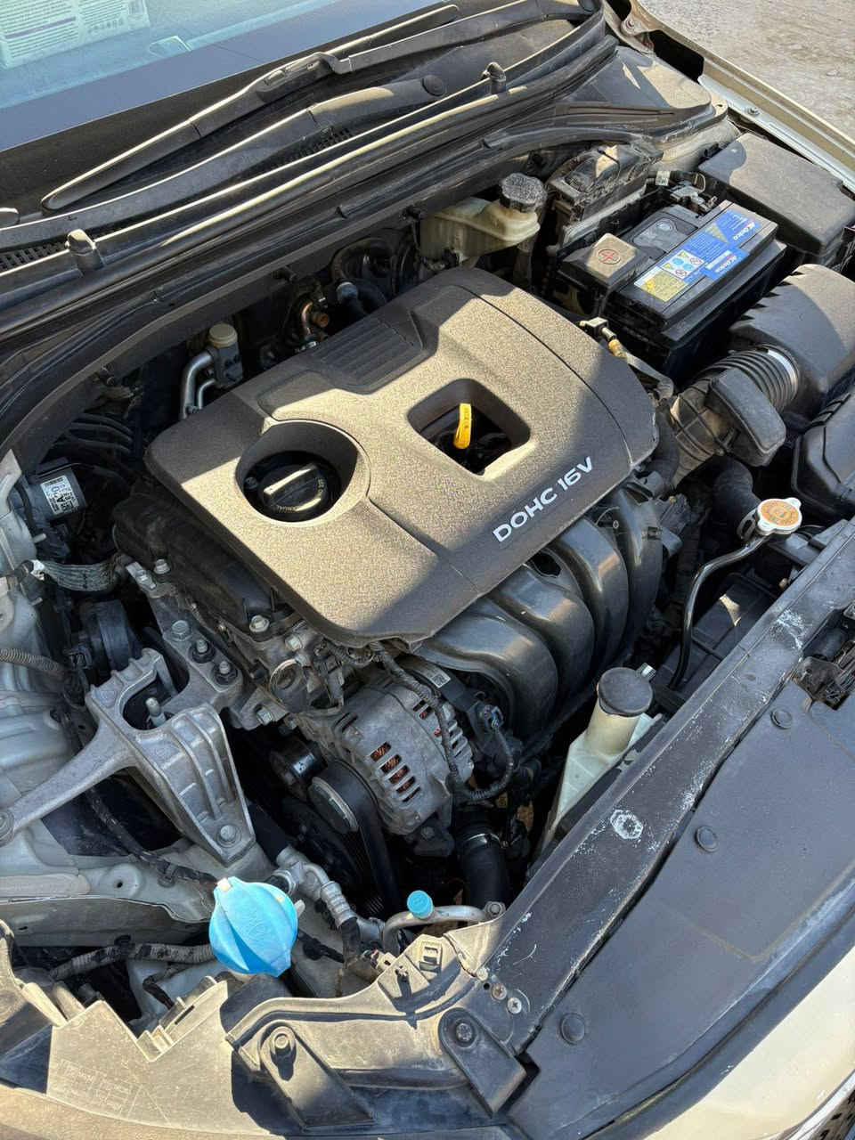 النترا امريكي 2017 رقم سليمانيه 
المحرك 1800 دوش المرغوب
سياره لوني ذهبي 
 والسنوية تنتهي 2030 بأسمي جديده
والفحص مالتها و الهزه لحد نهايه شهر السابع 
اذا تجددها متحتاج تاخذ السياره وياك..تروح بس انت والسنويه 
السياره ماشيه ٩٧٥٠٠ 
صدر السياره جيد 
تخم تايرات جديد 
تخم بلكات اصليه جديده
باتري جديد وبي ضمان سنه من شركة الديار 
سياره مواصفات عاديه 
وضربه حلوه مثل ماوضح بالصوره 
وبيه قطع صبغ مثل ماوضح بالسونار
نواقص السياره ( تبريد عاطل ) ويرادله بعض الرتوش البسيطه 
السياره سعرها حلو 10,500 يعني ١٠،٥٠٠ ورقات
مكاني اليرموك 
***********
