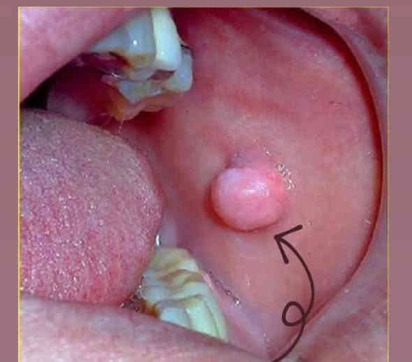 السلام عليكم ، اذا احد عنده هيج حالات بالفم ف يتواصل وياي ، واي شي يشوفه مو طبيعي داخل الفم يدزلي صورته حتى نحدد موعد للعلاج
***********
