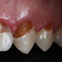 مجانا • حشوات وقلع • جامعة واسط