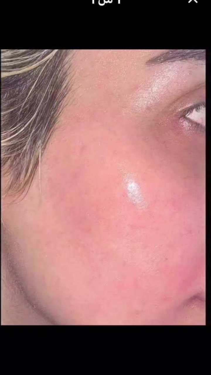 والله العظيم من تعلقون يجون يشترون مني وادعيلكم
ربي بجاه هذا الشهر كون كل وحدة تعلقلي ربي يبشرها بالقسمة والذرية والبيت والرزق والعافيه يارب
والنبي حنطيكم خلطة تخلي الوجه كيمرخلال يومين وحق العباس ابو فاضل دخيل اسمه ماحلف جذب لو امووت وداعت جهالي 
 اطيج خلطه ايرانيه للوجه وصابونه اذا مو 7 ايام خلت وجهج كيمر والحسين فلووسج ترجع باب بيتكم اقوا كلف زيله نمش تصبغات حبووب اثار الحبوب كولشي تنسوون @أبرز المعجبين


**إذا كنت صاحب هذا الإعلان وتريد حذفه لأي سبب، رجاءا أرسل رسالة إلى الدعم الفني**