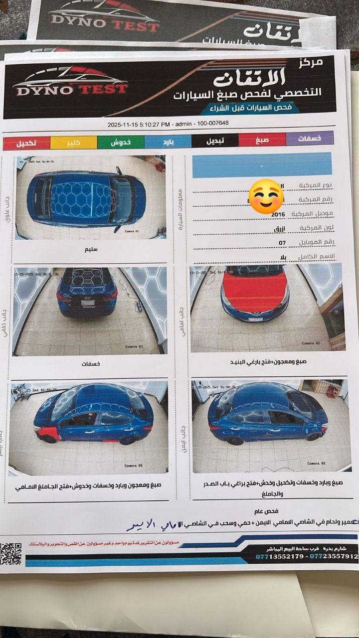 السلام عليكم بيع مستعجل النترا 16 سيارة سونار موجود بصور سيارة مرتبة وكلة جديد تخم تاير صدر مامي خلفي كله جديد ومستعجل ابيع   رقم الهاتف *********** 
مكان مسروكية كوت
