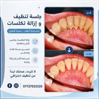 جلسة تنظيف • تنظيف بشرة • ازالة تكلسات • خدمات تجميل • صالون تجميل • ب...