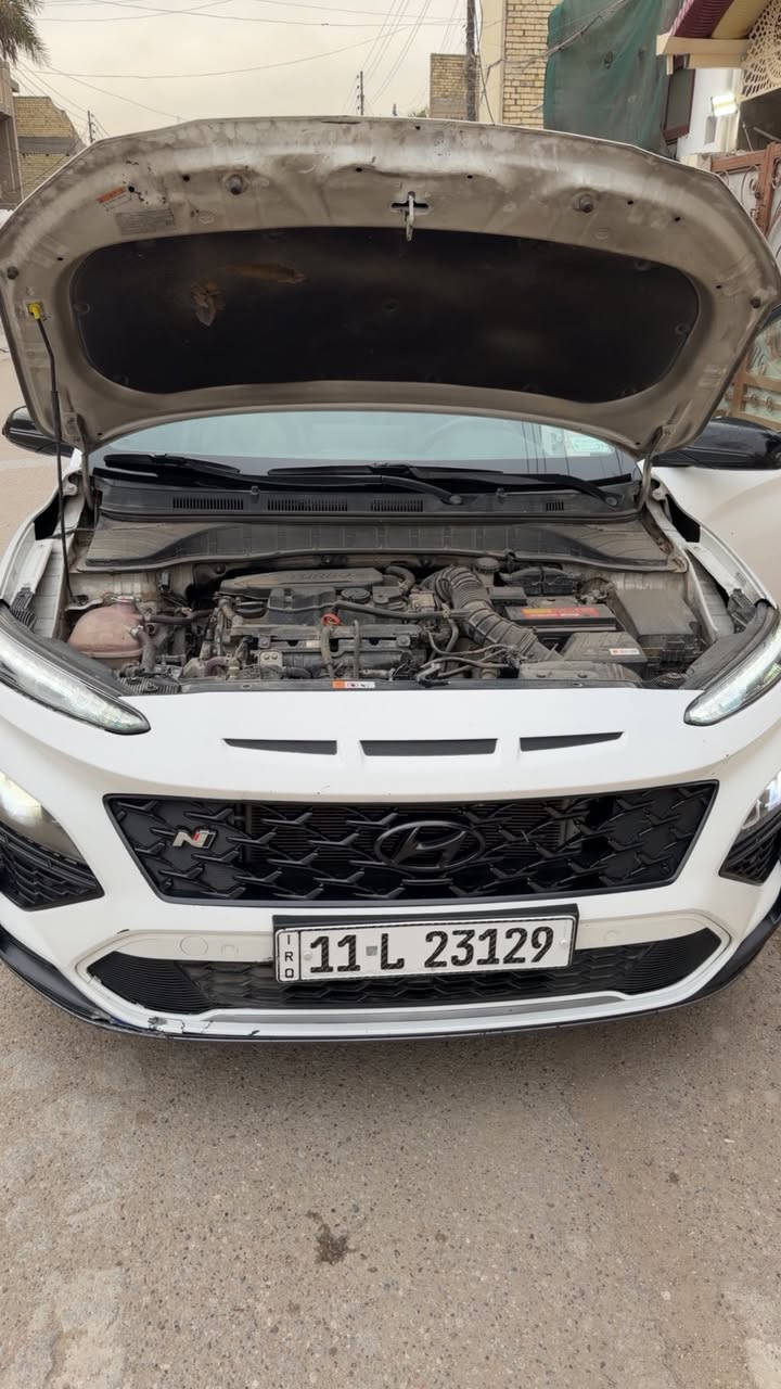 سلام عليكم للبيع كونا Nالرياضي فول واحد عله واحد سياره تيربو ١٦٠٠ لايت عدسات بكلاييت ايل إيدي فتحه بصمه تشغيل عن بعد. 
حادث موضح بصور بدون ايرباك جاملغات ثنين صبغ وبنيد بارد 
معروضه ب١٥٨ وبيها مجال موديل 2022 
***********
