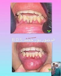 عروض عيادة الزهراء  تتواجد دكتورة طوال الأسبوع  يتواجد دكتور فقط صبح ع...