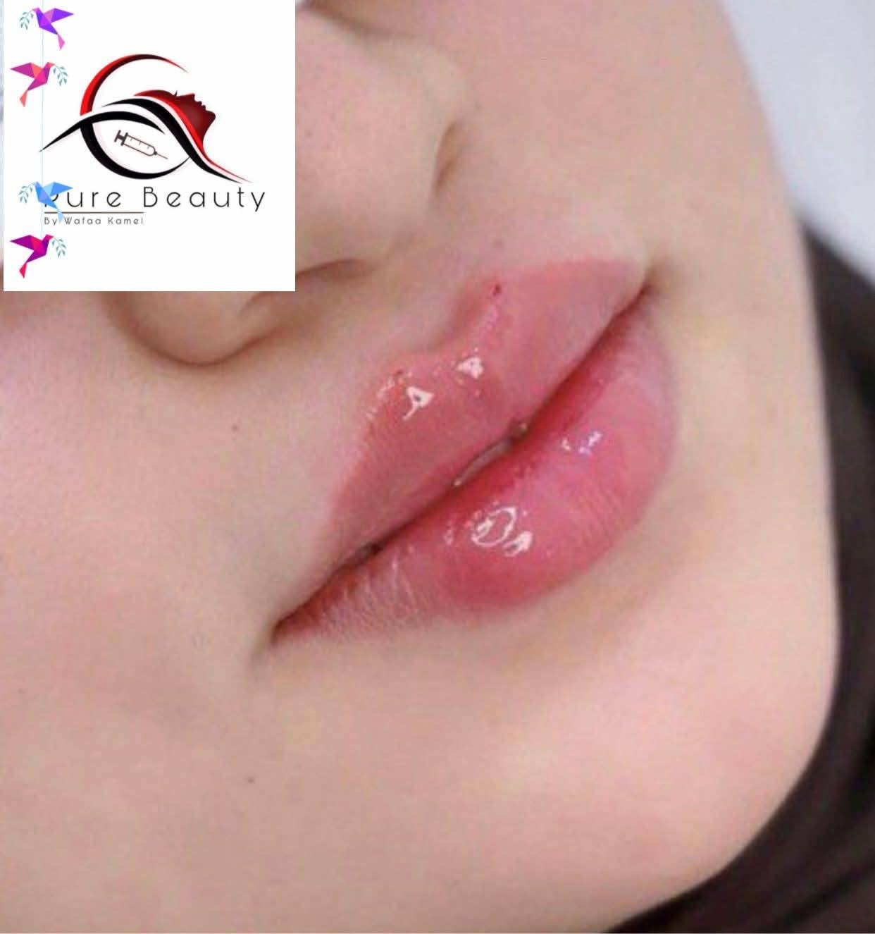 هلاو يا بنات 🥰💖 العيد قرب وحان الوقت لتبرزي جمالج الطبيعي بأحلى شكل! ✨
مع Pure Beauty للتجميل الجراحي، كل عملية تجميل عندنا بتكون احترافية وفخمة، والتفاصيل الصغيرة تصنع فرق كبير 😍💎
والأفضل؟ عروضنا الخاصة رح تخلي التجربة أكثر مغرية وكل بنت رح تحس بالتميز 🔥💫
📍 المكان: داخل مجمع بسمايه السكني
📲 للحجز: واتساب ***********
دللي نفسك وخلي جمالك يتألق بأمان واحترافية 😘✨
https://www.facebook.com/share/1C9cHiuph9/?mibextid=wwXIfr
