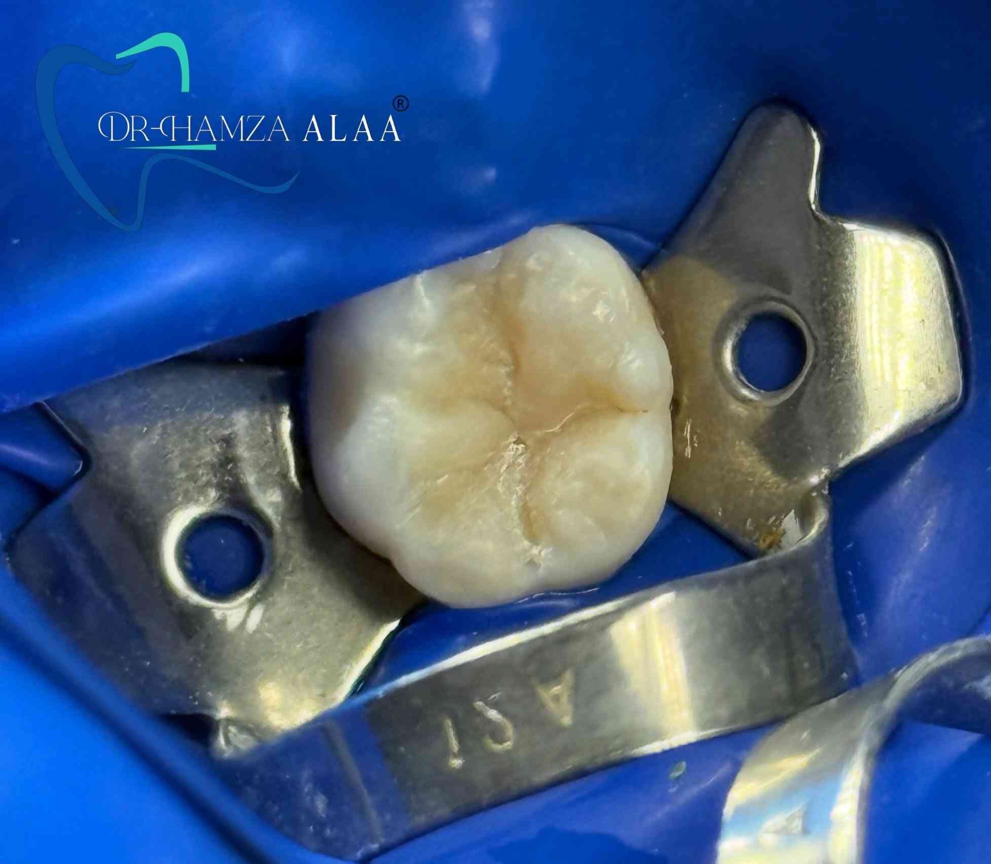 العنوان / بسماية الشارع العام 📍
للحجز والأستفسار مراسلة الصفحة او عن طريق الواتساب ***********📞

