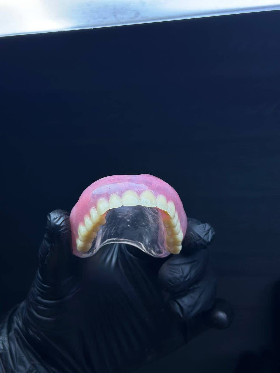 الي فاقد اسنان وحاب يعوضهن بطقم متحرك نفس الي بالصورة يتواصل وياي (الاسعار رمزية)
او على الواتساب ***********
