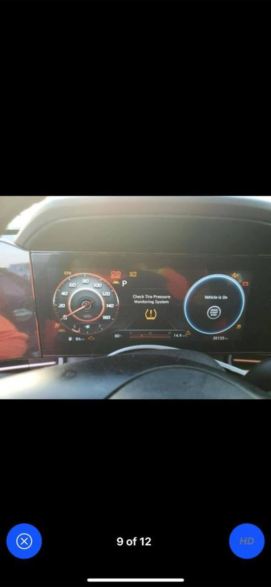 السلام عليكم النتره امريكيه موديل ٢٠٢٣
رقم بغداد الدولي وصور حادثهه مال امريكيه
وياهن بدون تبديل لبيل واحد نفسهن مصلحهن
صبغ ربع جاملغ وشويه من البريد السياره فول 
مواصفات عده الفتحه السياره جديده مال بيت 
كير مكينه حداديه صدر امامي خلفي كفاله عامه 
سعر السياره ١٤٥ورقه بيهه مجال بصيط حك جيتك 
مكان السياره بغداد الشعب شارع الصحه 
***********
