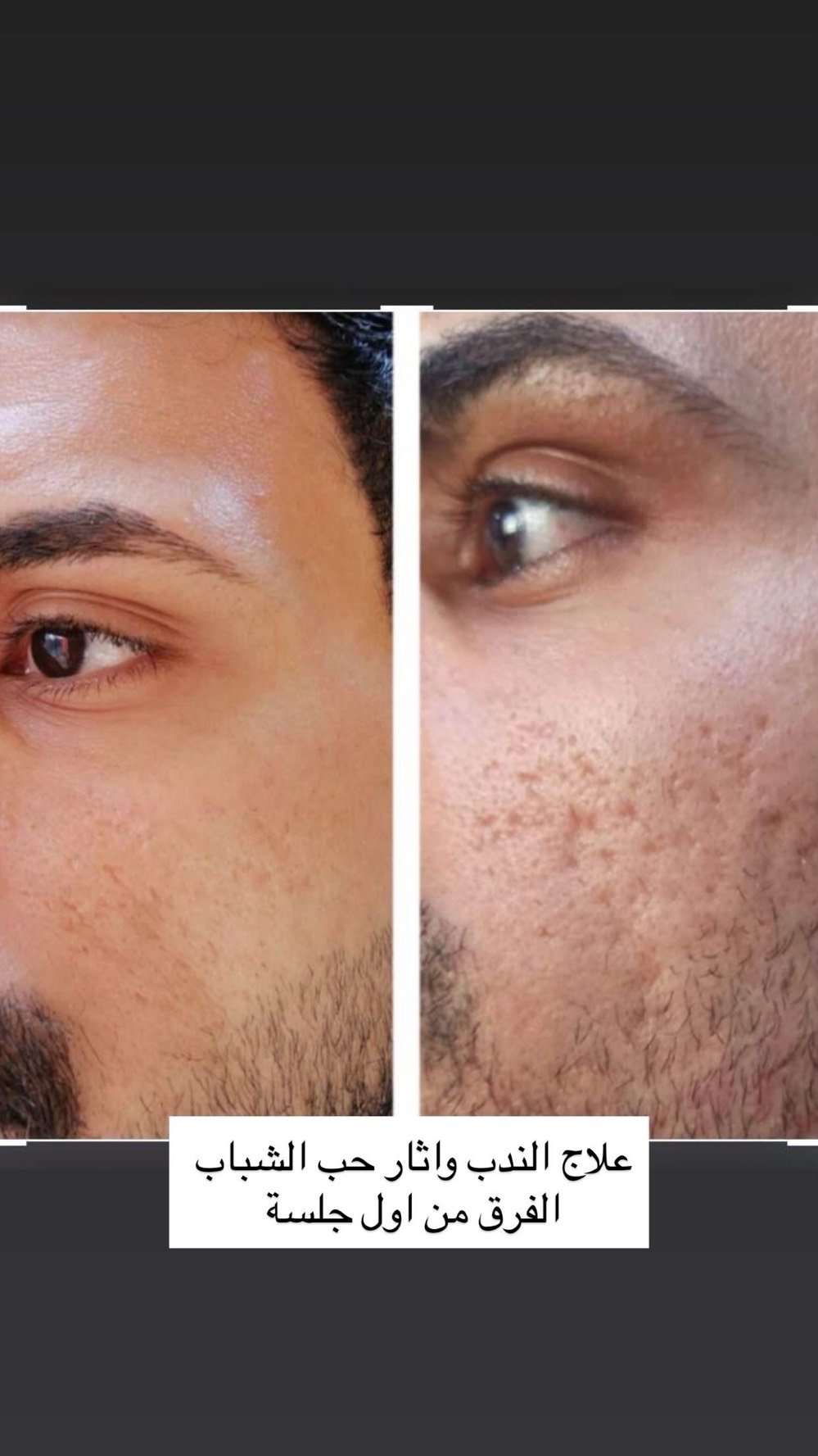 للتواصل والحجز/ ***********
زيونة/ 710 خدمي دريم ستي 
عيادة glow by raneen