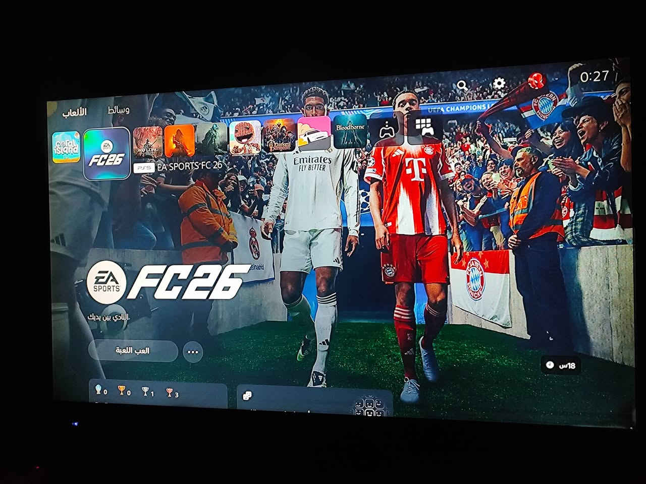 سوني 5مستعمل كامل ملحقاته معه UPS و حسابات فيفا 25و 26السعر 675
***********
واتساب
