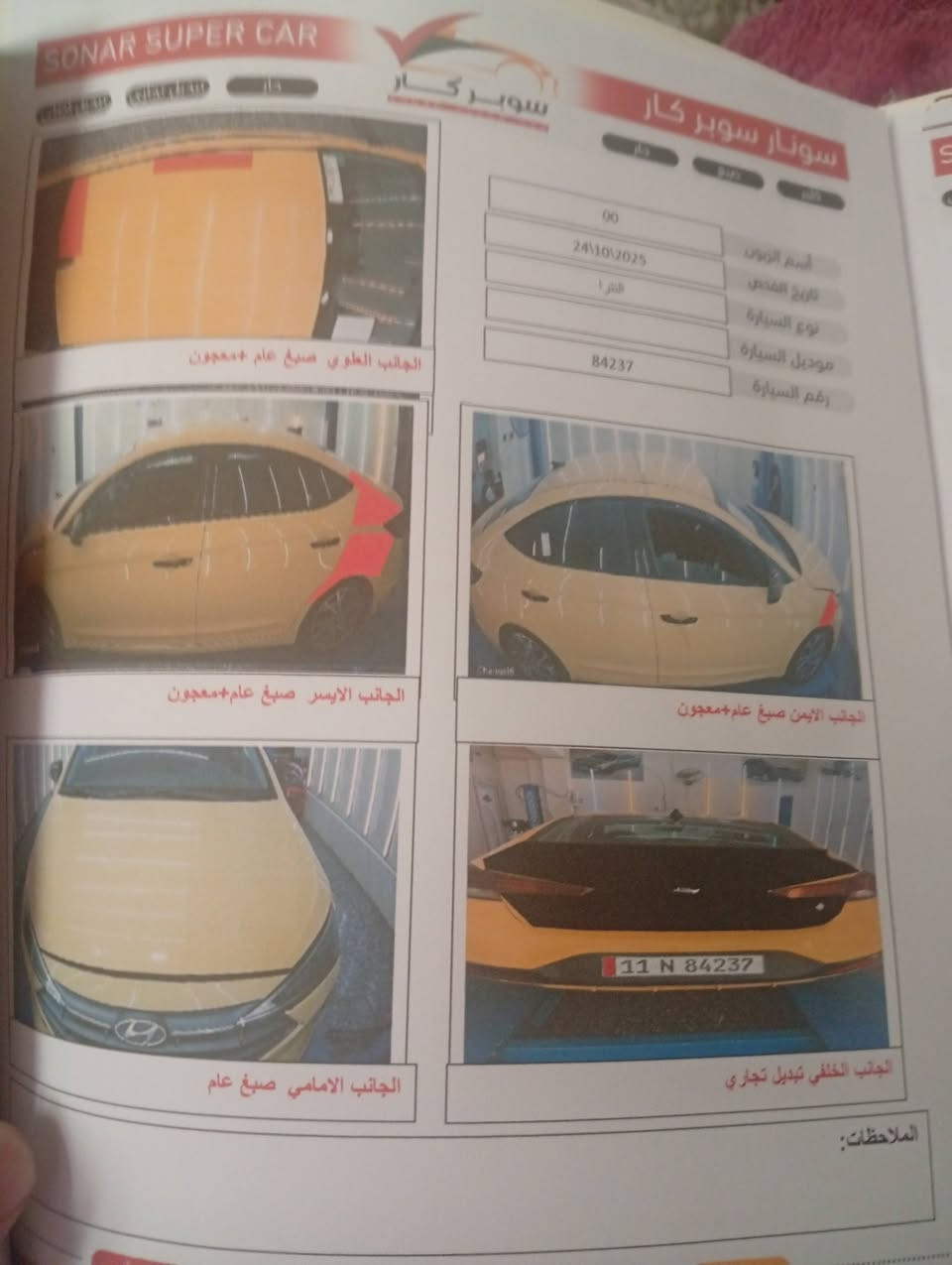 سلام وعليكم النترا موديل عشرين محور اي تي فول ماعده السقف ولبصمه حادثهه موجود بسونر مكان بغداد جديده بيهه خيط تبخيرقليل السعر 140 وبيهه مجال ***********
