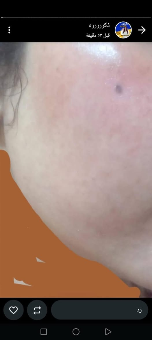 عيني  بنات
خلطه وجهه رجع توافرات
موصفات تنطي بيضاء  لبشره وتنعيم ازاله كلف نمش
مكوناته اعشاب طبيه مابيه اي اضرار ع بشره


**إذا كنت صاحب هذا الإعلان وتريد حذفه لأي سبب، رجاءا أرسل رسالة إلى الدعم الفني**