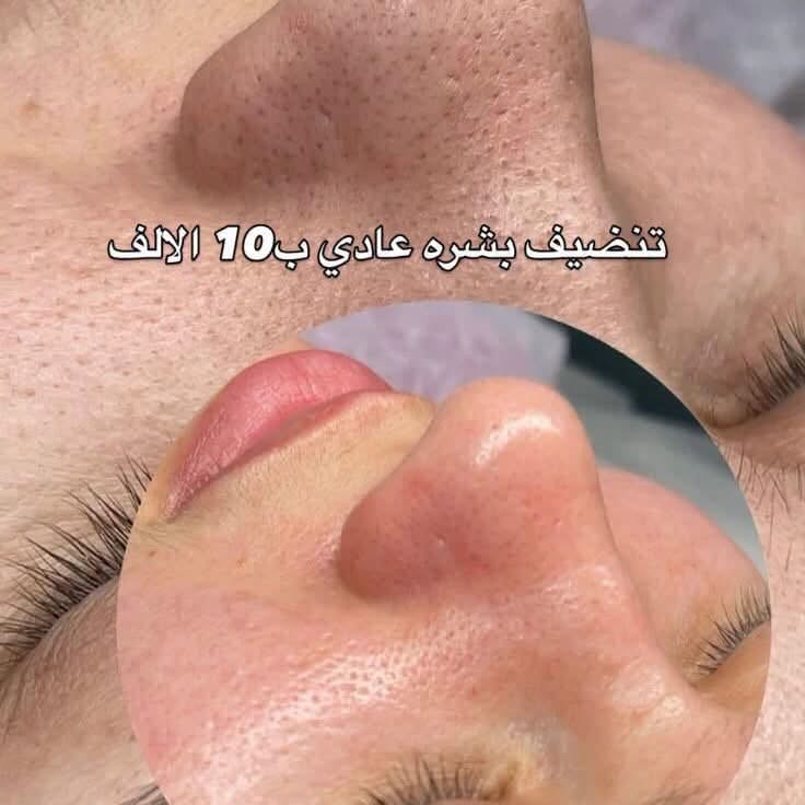 اهلا وسهلا جميلتنا عروض سبوت صبغ وتخصيل مع معالج مع بدكير مع قص مع شسوار ٤٠ العرض الثاني صبغ مع معالج مع تنضيف قدم مع معالج ٢٥ تنضيف قدم ٥جلش ٥قص ٥رموش ١٥ تنضيف بشره ١٠ معالج وتسريحً٥٠ جل اكستنشن ٢٠ العامريه شارع المضيف مقابيل كافي ليمونه طابق *********** اهلا وسهلا جميلتنا
