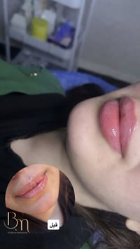 عيادة التجميل الاولى في الحسينية وتحت إشراف أطباء مختصين وبأنسب أسعار ...