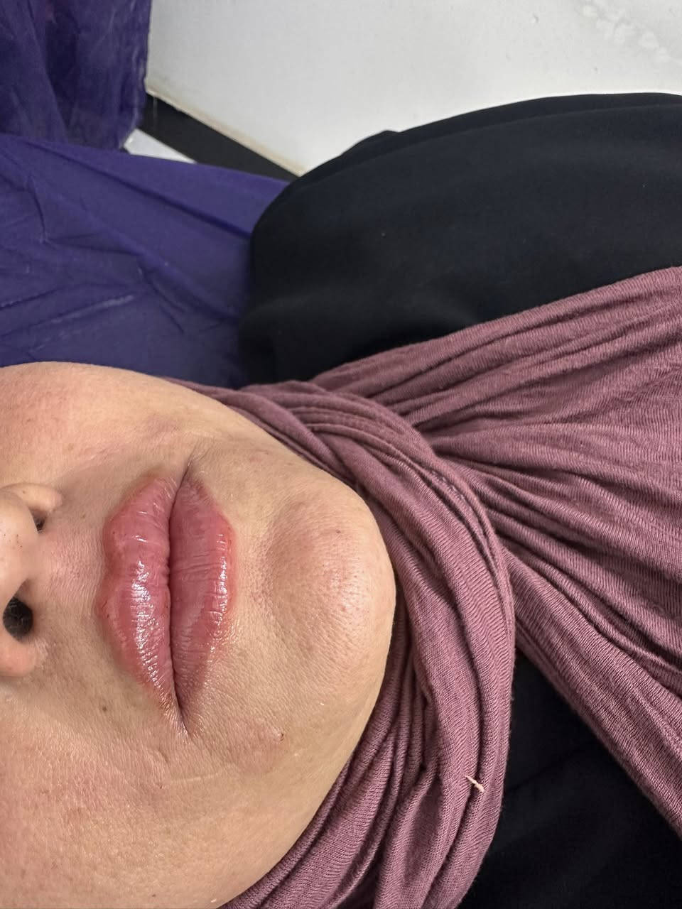 عيادة الدكتورة شذى عبد الامير للجلدية والتجميل شارع العمارة الحمرة مجاور معهد الشمس
ماكيره فاطمهام اسد@
