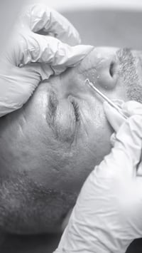 تنظيف بشرة • مركز الشرق الاوسط • الشطرة ذي قار