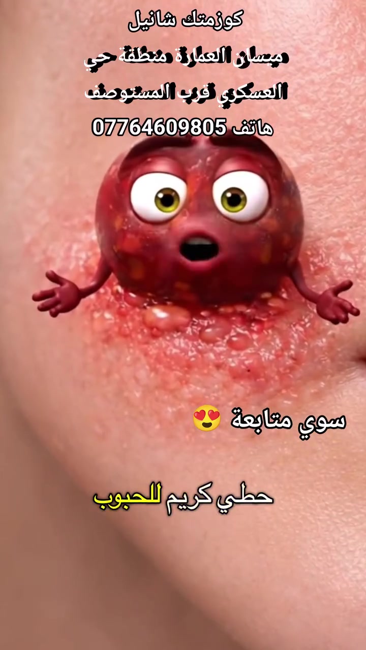 جمالكم بنات يمنا كوزمتك شانيل الأول في العمارة


**إذا كنت صاحب هذا الإعلان وتريد حذفه لأي سبب، رجاءا أرسل رسالة إلى الدعم الفني**