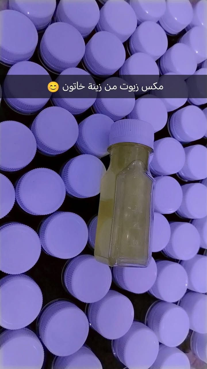 مكس الزيوت عالم من التغذية الطبيعية للشعر يعالج مشكلة التساقط والقشرة والهيشان والشعر الباهت وفروة الرأس بشكل كبير جداً،تطويل تنعيم شعر صحي مية بالمية 💯 
ونتيجة من أول استخدام ،مضمون وفعال 

من زيــــنة خاتــــون 👸🏻 كولـشي مـن عـندها مضمـون 🫶 
 ❣️ تابعونا على الروابط التالية 

❣️ ❣️ ❣️ رابط البيج على الفيس
‏https://www.facebook.com/profile.php?id=100084399243220&mibextid=ZbWKwL

❣️ ❣️ ❣️ رابط حساب زينة خاتون على الفيس 
‏https://www.facebook.com/profile.php?id=100084266915505&mibextid=ZbWKwL

❣️ ❣️ ❣️ رابط قناة التلي
‏ https://t.me/zozo1995zozo

❣️ ❣️ ❣️ رابط الانستا 
‏https://www.instagram.com/ze95naa?igsh=cmU3ejNpaDhlajVo

❣️ ❣️ ❣️
رابط التيك توك الصفحة الرئيسية 
https://www.tiktok.com/@zenazozo95?_t=ZS-8szORmSzk2x&_r=1

🍒🍒رابط التيك توك الصفحة الإحتياطية 

https://www.tiktok.com/@zenazozo30?_r=1&_t=ZS-94j0YB2EAGf


**إذا كنت صاحب هذا الإعلان وتريد حذفه لأي سبب، رجاءا أرسل رسالة إلى الدعم الفني**