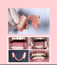 طقم جزئي • تنظيف اسنان • ناصرية التضحيه
