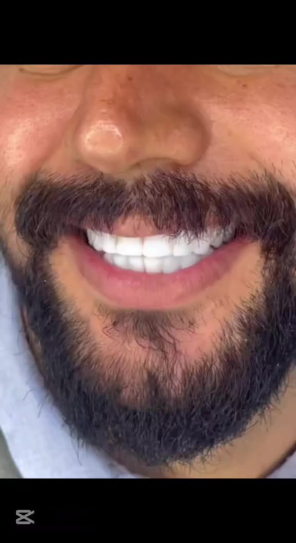 ابتسامة ما تنسى لكل الأعمار! ✨
بسعر مغري جدا لفترة محدوده

جلسة سريعة، نتيجة فورية… الكل يستحق يبتسم بثقة 💎

عيادة دكتورة الدكتورة هند الحسيني 
***********
