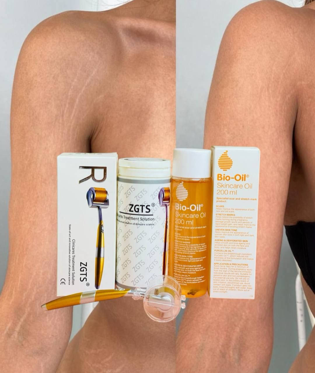 وداعاً للخطوط الحمراء والبيضاء واهلاً ببشرة كالحرير بدون خطوط ...
وياي بكجانا راح نخليج تتخلصين من الاحراج وتعيدين الثقة بنفسج المنتج اصلي وشرط الفحص وقابل للترجيع ...
أين كان نوع التشققات حمراء_بيضاء صارت عندج بسبب الحمل_السمنه_اثار حروق_ندوب كل هل مشاكل نعالجها بكج يتكون من:

🧖‍♀️ أولاً: ديرمارول الأصلية 💯
تساعد على تجديد خلايا البشرة وتحفيز الكولاجين، وفوائدها:
✅ تقليل التشققات وعلامات التمدد
✅ تحسين مرونة وملمس الجلد
✅ تصغير المسام
✅ تخفيف آثار حب الشباب والندوب
✅ تقليل الخطوط والتجاعيد
🌿 ثانياً: زيت بايو أويل الأصلي 💯💯
زيت فعال لتحسين مظهر البشرة:
✅ تقليل التشققات والخطوط البيضاء
✅ توحيد لون البشرة والتصبغات
✅ تحسين آثار الندوب والحروق
✅ ترطيب البشرة الجافة ومنحها نعومة


**إذا كنت صاحب هذا الإعلان وتريد حذفه لأي سبب، رجاءا أرسل رسالة إلى الدعم الفني**