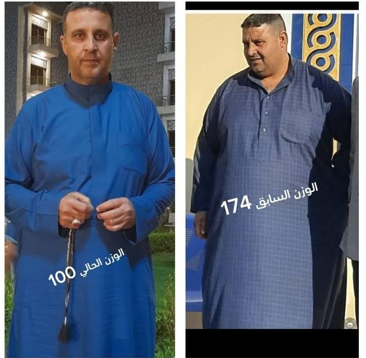 بشرى ساره لأهلنا في محافظة واسط (قضاء الصويره) والمحافظات الجنوبية والفرات الأوسط
@الجميع
مع البروفيسور الجراح
الدكتور. محمد الطائي
يتواجد الدكتور كل يوم خميس لأجراء العمليات 
والأستشاره الطبية

عملية قص المعدة 
(مليونين و٦٠٠) شاملة
عملية تحويل المسار 
( 4 مليون) شاملة
عرض لفترة محدودة 

هذا العرض يشمل :
1- مجموعة مستشفيات المؤيد. 
مستشفى المؤيد الاهلي(3) في قضاء الصويرة / شارع النجمة.

2- كافة تحاليل العملية والفحوصات التي تشمل 
(الأشعة + السونار + الأيكو +  تخطيط القلب). 

3- علاج العمليه والرقود. 
 
4- رقود لمدة يومين. 

5- عناية طبية من قبل الطبيب المقيم للبروفيسور... وتمريضية متميزة من قبل كادر متكامل. 

6- كافة مستلزمات العملية. 

7- كراس نظام غذائي علاجي مطور ما بعد العملية. 

8- متابعة فعلية مابعد العملية عن طريق كروب من قبل البروفيسور. 

9_الادوات الامريكية الجيل الثالث حصرا الاحدث في عالم عمليات السمنة. 

للحجز و الاستفسار:
***********.
***********.
إدمن محمد

#محمد_الطائي
