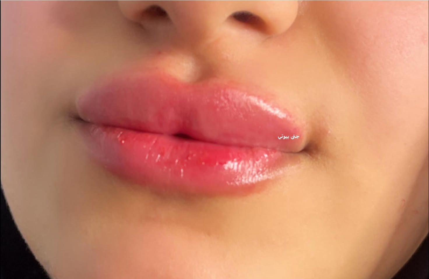 الجميله من كربلاء حقنا الشفاه قبل سنتين 
واليوم جددنا الحقن💉💉
💋💋


**إذا كنت صاحب هذا الإعلان وتريد حذفه لأي سبب، رجاءا أرسل رسالة إلى الدعم الفني**