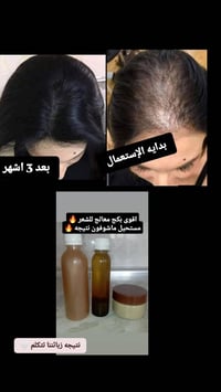 بكج • معالج شعر