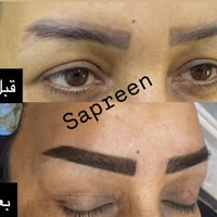 هلاو بنات شلونكم.  هاي حالة. من حالات تحويل تاتو قديم الى تاتو. شعيرات...