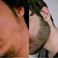 زيت تريتونيا • طبيعي ١٠٠٪ • نمو سريع