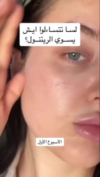 سيروم ريتينول • SOME BY MI • توصيل العراق