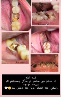 الي يحتاج يراسلنه وبالخدمه يدلل واتساب انستا فقط   واتساب 07783851055 ...