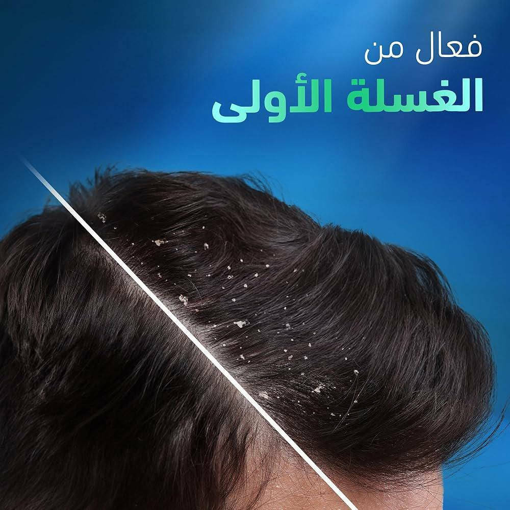 شامبو هيد اند شولدرز الشكل الجديد الشفاف
خالي من السليكون
خالي من الباربين
خالي من البارفين


**إذا كنت صاحب هذا الإعلان وتريد حذفه لأي سبب، رجاءا أرسل رسالة إلى الدعم الفني**