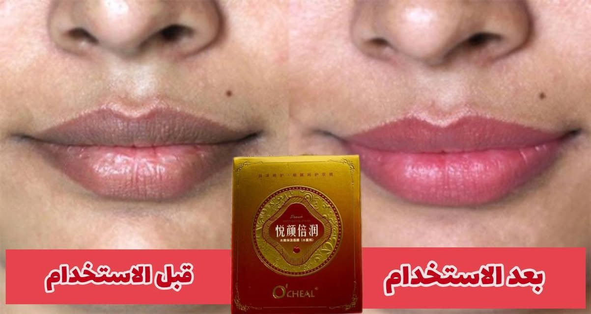 كريم دم التنين الاصلي 💋💋
كريم ماسك دم التنين ♥️♥️
مرطب ومورد مغذي شفايف يملئ الخطوط ويغذي الشفاه الجافة ويرطبها 
فوائده. 
🌸يورد الشفه 
🌸يمنع تكسر الشفه
🌸يزيل خطوط الشفه 
🌸يغذي ويرطب الشفة 
🌸يمنع ويعالج التشققات 

تواصل خاص 
🚘يوجد خدمة توصيل لجميع محافظات العراق ٥ الاف🚘


**إذا كنت صاحب هذا الإعلان وتريد حذفه لأي سبب، رجاءا أرسل رسالة إلى الدعم الفني**