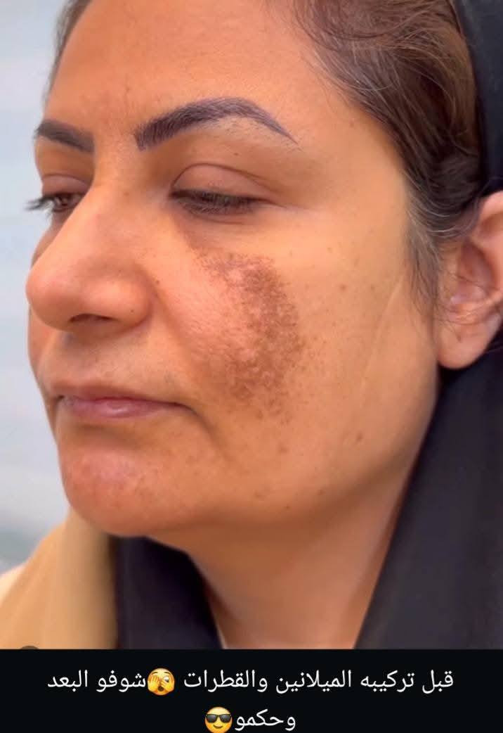 وبلشنا عروض العيد 

حتى كلكم تلحكون تحلون مشاكلكم 

الي يحب يستفسر ع عروض يتفضل ع خاص 
🌷


**إذا كنت صاحب هذا الإعلان وتريد حذفه لأي سبب، رجاءا أرسل رسالة إلى الدعم الفني**