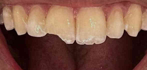 السلام عليكم 
الي عنده هيج تسوسات او كسر بالسن محتاج قلع نكدر نعالجهم مجاناً في عيادات الجامعه الوطنيه 
(العمل مجاناً وباشراف اطباء اختصاص )
للاستفسار:***********
