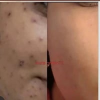 نتيجه أحد الزبونات الي حبت تشارك تجربتها ويانا بعد حصولها على النتيجه ...