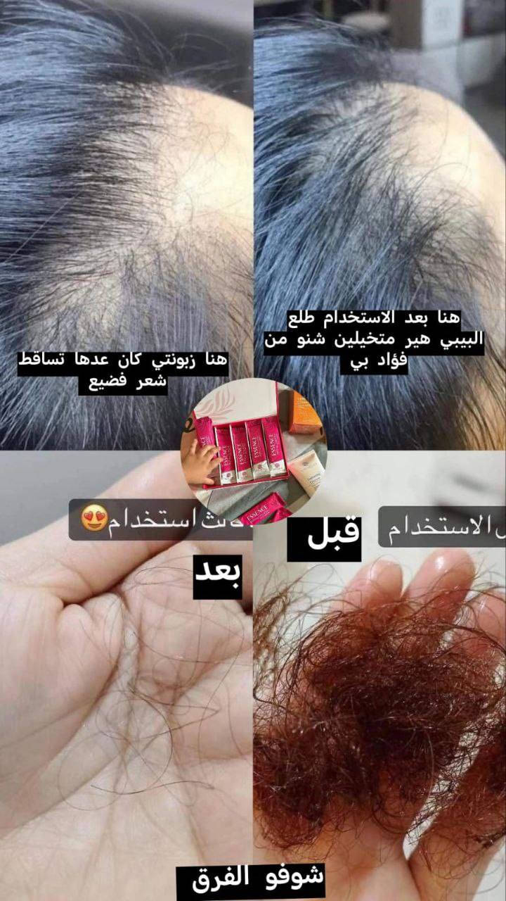 النتائج تبين من بعد اسبوعين من الاستخدام عن تجربتنا وتجربه الفريق
عنايه داخليه و خارجيه لبصيله الشعر وتقويها وتوقف التساقط وبمرور الوقت تقل التقصفات وتحسنه وتغذيه ولمعان يجنن


**إذا كنت صاحب هذا الإعلان وتريد حذفه لأي سبب، رجاءا أرسل رسالة إلى الدعم الفني**