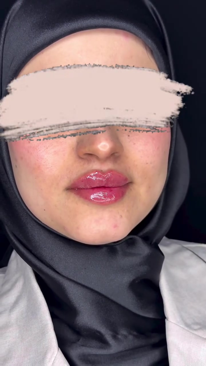 عن تجربتي اليوم شغل الدكتورة حنين الصراف
يجنن شوفن

https://www.facebook.com/share/r/1Bn2uP7PCc/?mibextid=WC7FNe


**إذا كنت صاحب هذا الإعلان وتريد حذفه لأي سبب، رجاءا أرسل رسالة إلى الدعم الفني**