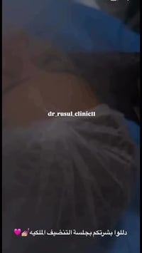 ✨ بشرة ملكية تبدأ من تنظيف عميق وصحيح  إذا بشرتك: 🔹 باهتة 🔹 بيها رؤوس ...