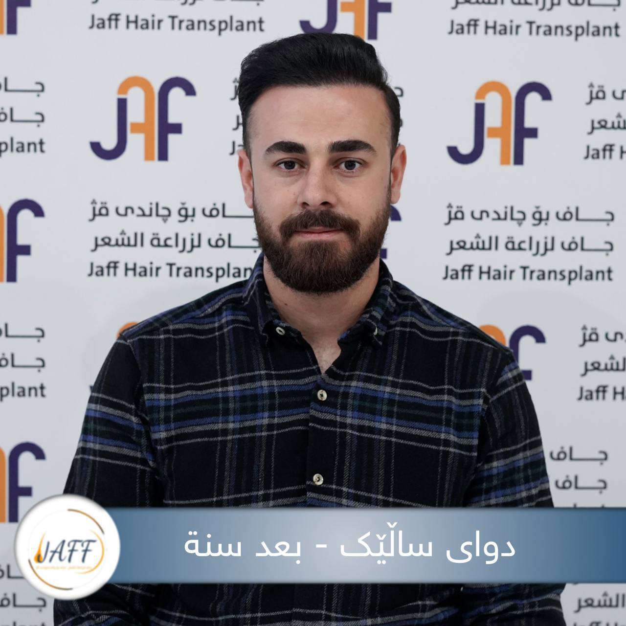 بعد زراعة الشعر في مركز جاف ستحصل على أجمل ستايل جديد ومظهر أكثر ثقة وجاذبية، لذلك ليكن خيارك الدائم هو مركز جاف للحصول على أفضل النتائج.

♦  مع جاف حافظ على شبابك.

📍 العنوان: كلار، عمارة جاف الطبية،  شارع رئيسي سوق - حي الموظفين مقابل مكتب حزب یەکگرتو سابقا.

📞 رقم التواصل:
***********
🔹🔹🔹🔹🔹🔹🔹🔸🔸🔸🔸🔸🔸🔸🔸
دوای چاندنەوەی قژ لە سەنتەری جاف ، ستایلێکی نوێ و جوان بەدەست دەهێنیت. بۆیە باشترین هەڵبژاردەت سەنتەری جافە بۆ گۆڕینی دیمەن و ڕوخسارت .

♦ لەگەڵ جاف هەمیشە بەگەنجی دەمێنێتەوە 

📍  ناونیشان: کەلار، تەلاری پزیشکی جاف، بەرامبەر مەڵبەندی یەکگرتوو .

📞  ***********
